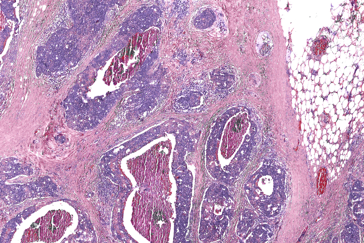 A ground-up approach to cancer research, staring with basic science and engineering, is the key to future clinical development &mdash; such as dye-free digital biopsies like this one, says Cancer Center at Illinois director Rohit Bhargava. Image courtesy of Rohit Bhargava