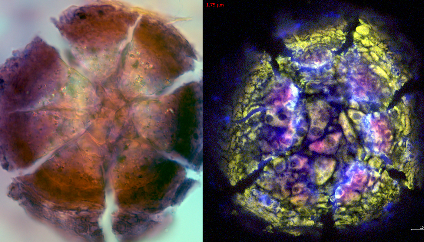 <em>Each of the 12 modes of analysis provided different insights into calcifications&rsquo; structure, composition and formation, adding up to a holistic picture. This sample of DCIS showed characteristics similar to those of petrified wood, revealing changes in tissue physiology as the cancer progressed. Image by Mayandi Sivaguru</em>
