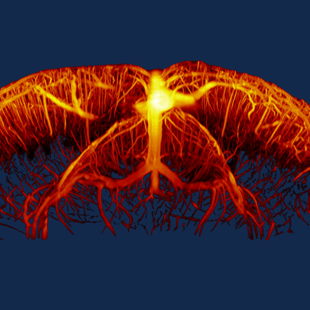 <em>3D volumetric ultrasound captures&nbsp;data on both depth and motion in real time. This example shows the network of tiny blood vessels in a mouse brain.</em>