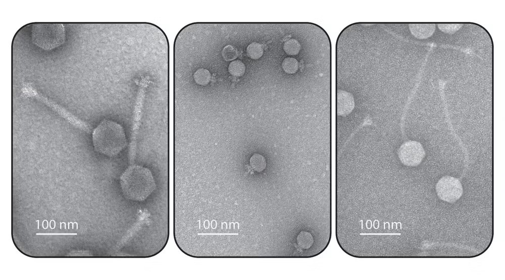 Electron micrographs of bacterial viruses, also known as phages. Hatoum-Aslan lab, University of Illinois.