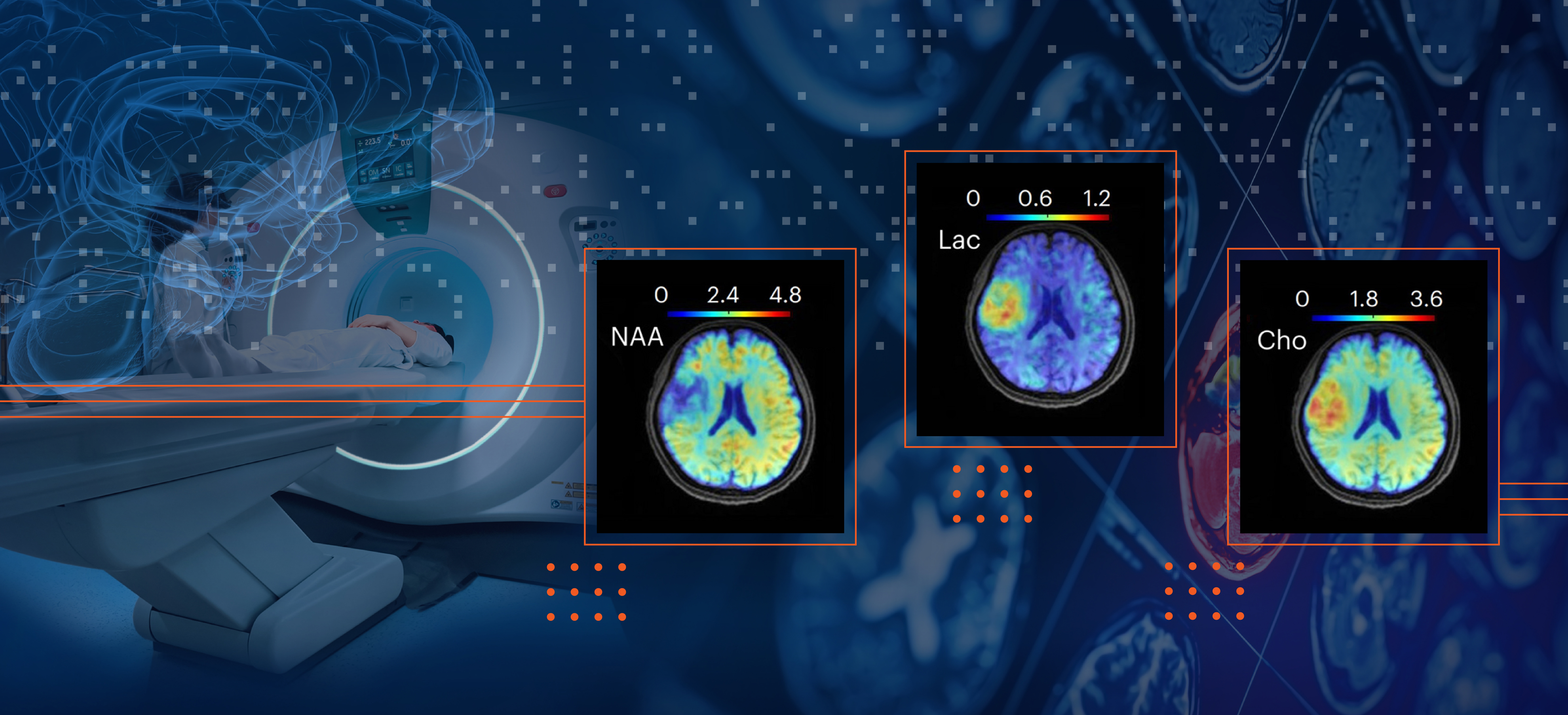 A man in an MRI machine