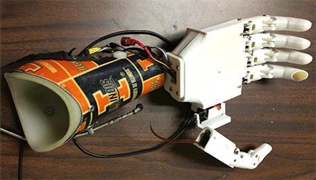 Quantact's prosthetic hand featuring sensory element (and orange-and-blue Illini covering).