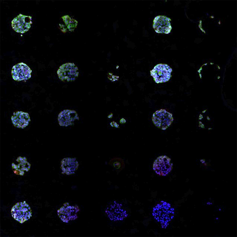 A chemical array screens for malignant melanoma cell types. Each dot contains a different combination of protein segments derived from the tumor environment.
Image courtesy of Kristopher Kilian