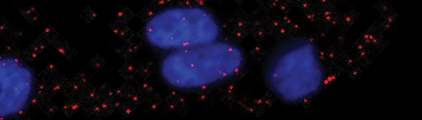 The breast cancer cells' nuclei are illuminated (blue) by quantum dots and individual EGF growth factors appear as red spots.
