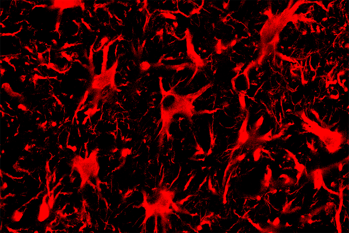 Spinal cord astrocytes, the cells seen in this fluorescent microscope image, are involved in the progression of ALS. A new CRISPR-Cas13 system targeting mutant protein production in these cells improved outcomes for mice with ALS. Image courtesy of Thomas Gaj and Colin Lim