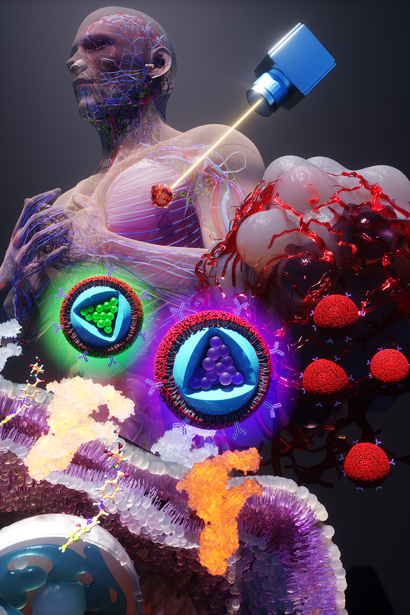 One wavelength of laser light during surgery elicits two distinct signals from the membrane-wrapped nanoparticles, one color for each of the two biomarkers that the nanoparticles target. One is common in earlier stages of cancer, and the other indicates later-stage &amp;ndash; and possibly metastatic &amp;ndash; cancer.&amp;nbsp;