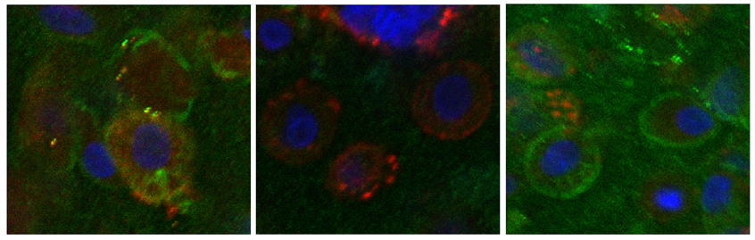From left: normal cells, cells lacking expression of DMD due to loss of exon 44, and recovery of dystrophin expression in cells lacking exon 44 following skipping of exon 45. Blue: DNA. Green: dystophin.&amp;nbsp;Red: MF20.