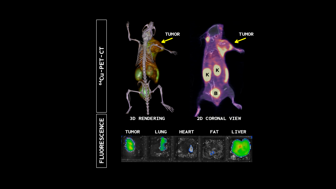 Molecular PET-CT and fluorescence imaging of the receptor for advanced glycation end-products (RAGE) with a multimodal Copper-64/Cy-7 labeled RAGE antagonistic peptide in a murine 4T1 breast cancer xenograft model.